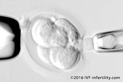 Single cell removed from an eight cell embryo.